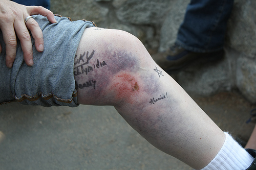 Forum member supplied image with no explanatory text