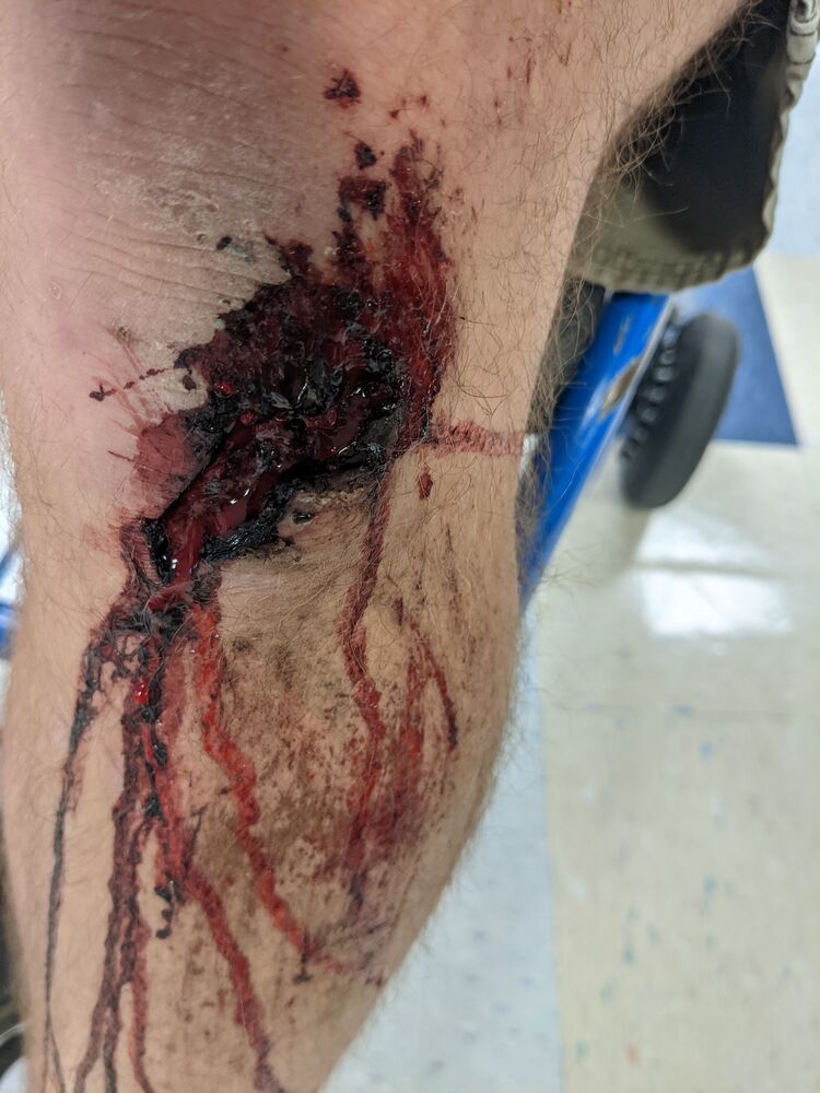 Forum member supplied image with no explanatory text