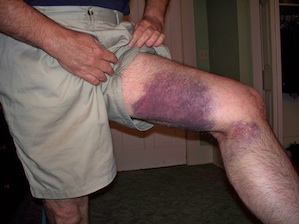 Forum member supplied image with no explanatory text