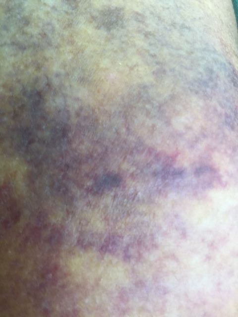 Forum member supplied image with no explanatory text