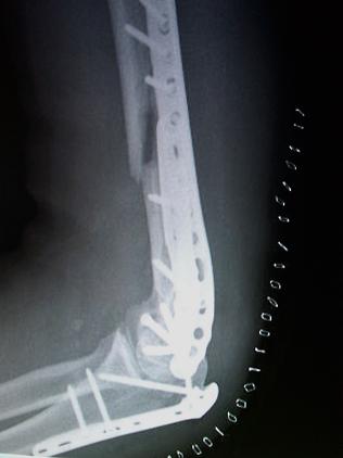 Forum member supplied image with no explanatory text