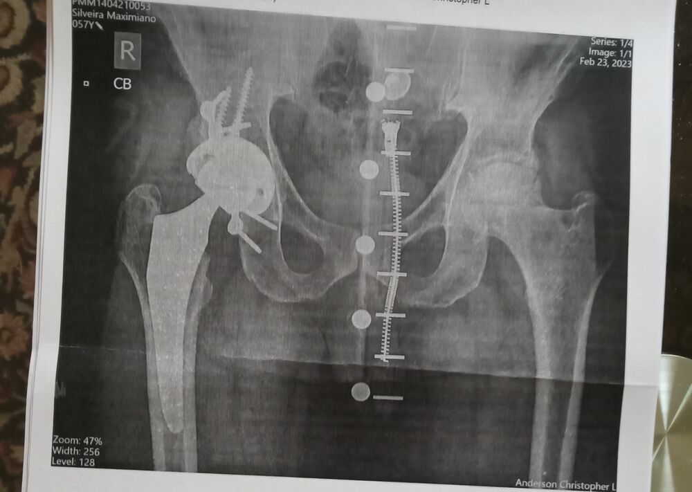 Forum member supplied image with no explanatory text