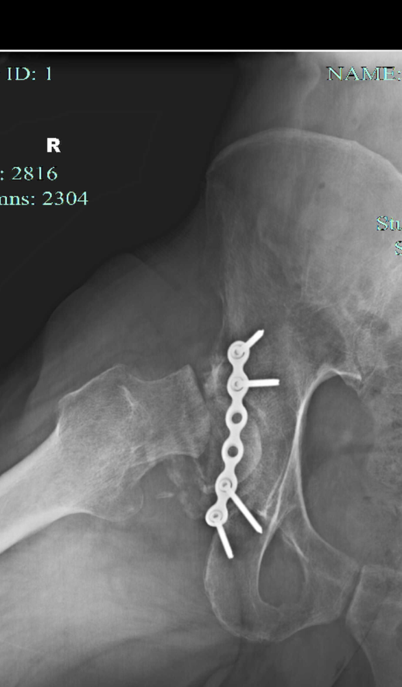 Forum member supplied image with no explanatory text