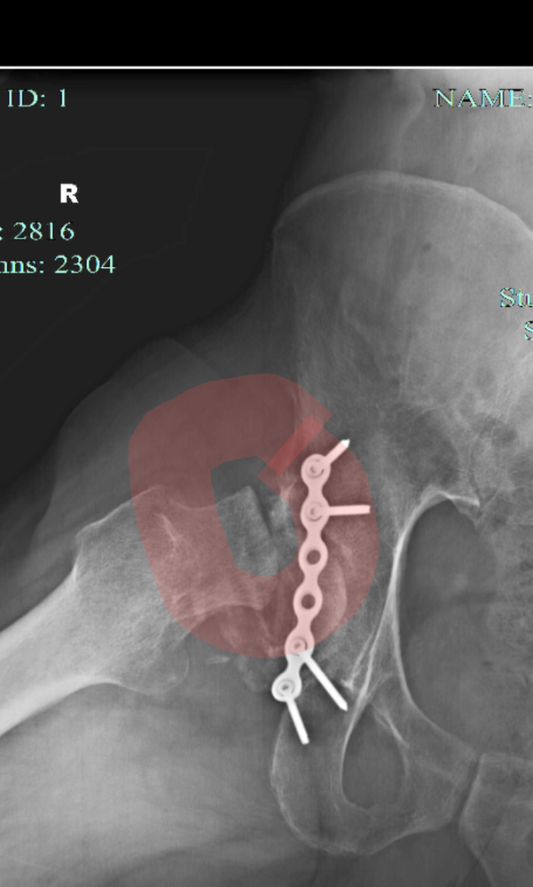 Forum member supplied image with no explanatory text