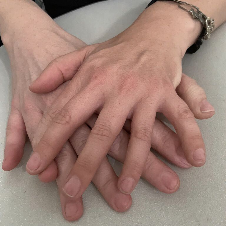 Handses.