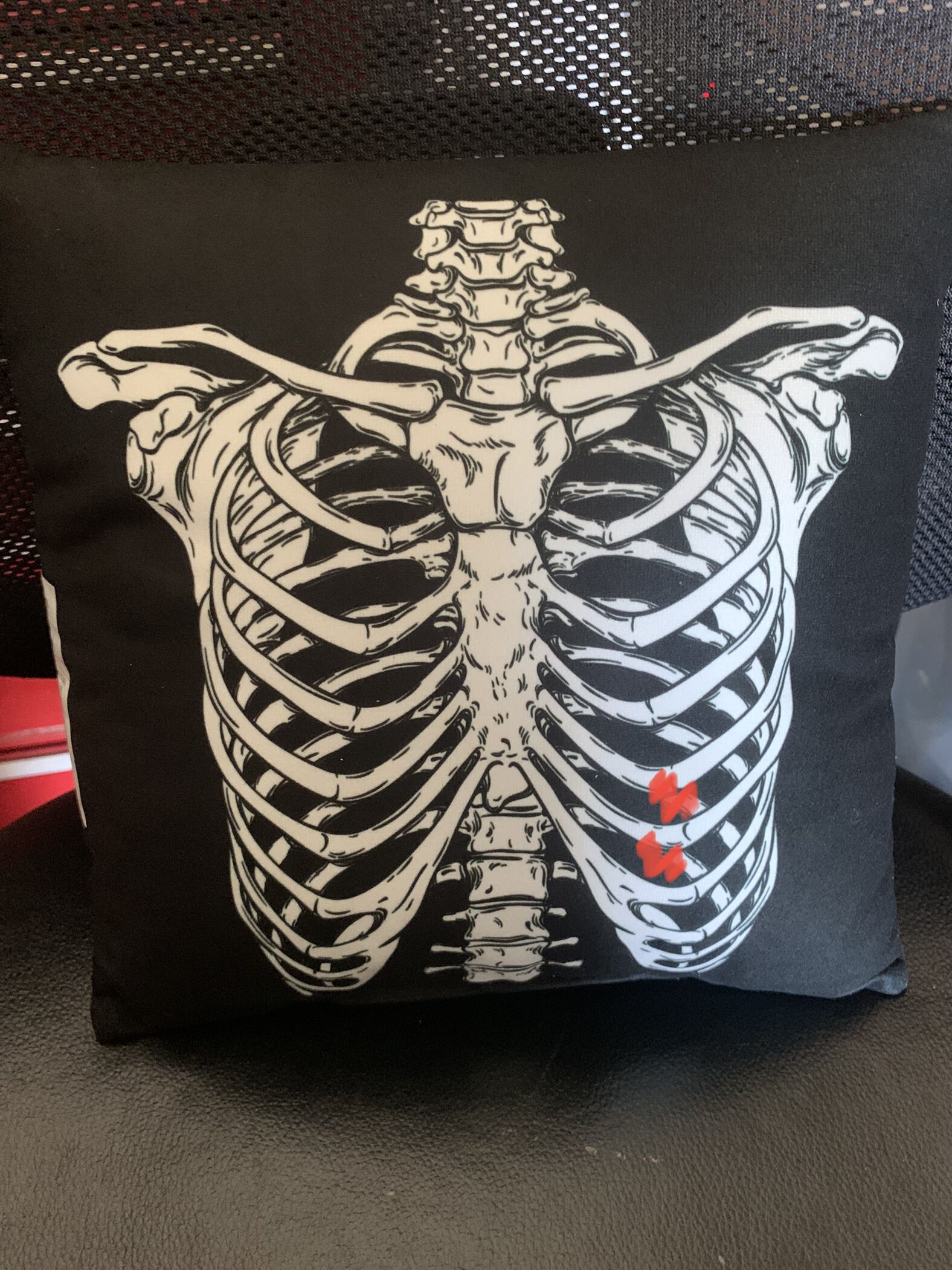 Hosp gave me this "rib pillow" as swag … approx location of fractures shown in red
